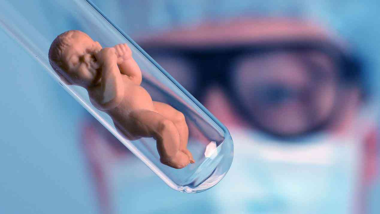 试管婴儿费用影响因素分析