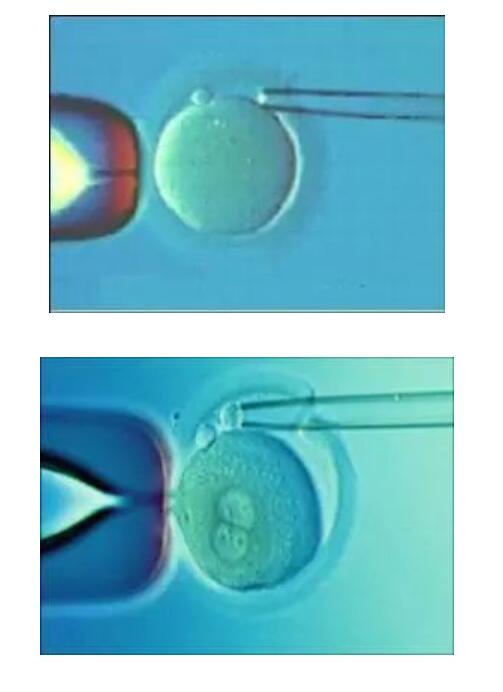 试管婴儿胚胎移植北京成功率分析