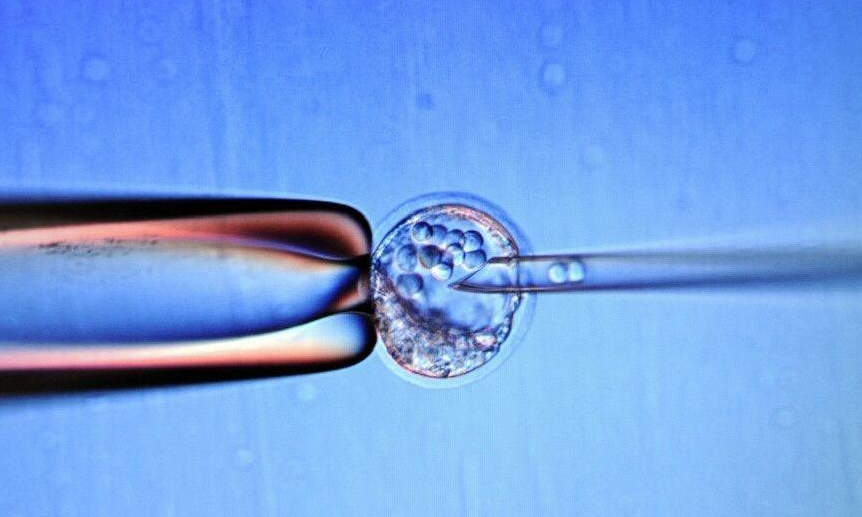 试管婴儿费用明细解读