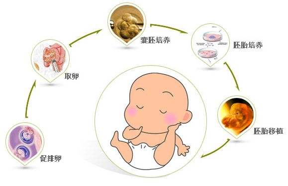 试管婴儿胚胎移植术后疼痛管理探讨